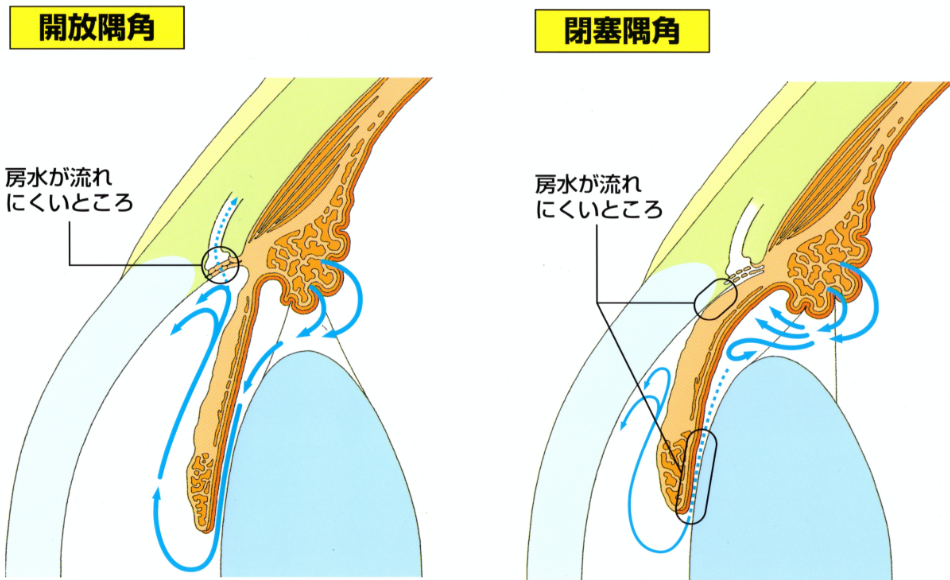 緑内障外来｜はっとり眼科クリニック
